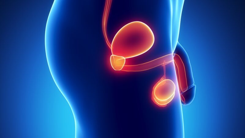 Rompiendo mitos: el cáncer de próstata no solo es una enfermedad de hombres mayores
